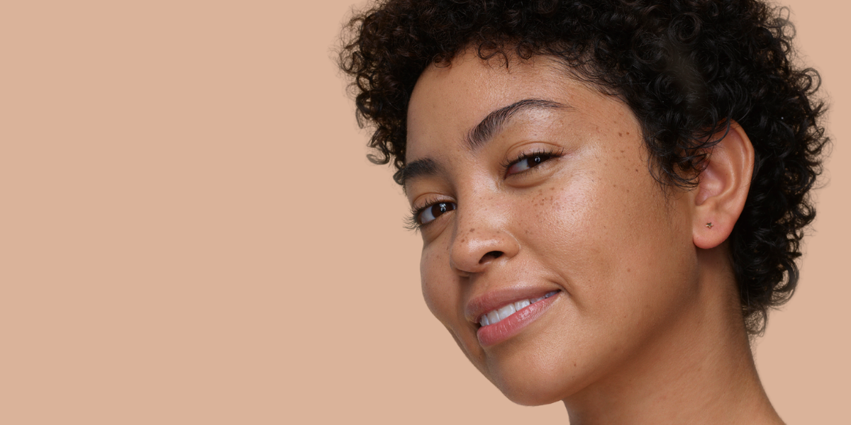 What is hyperpigmentation? (and what can we do about it)