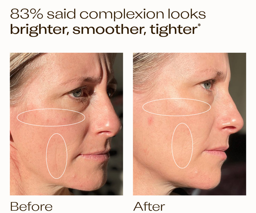 "Over the four weeks I have noticed an overall improvement in my skin condition, it is more hydrated, skin tone seems more even, redness has reduced. It feels lovely on the skin and absorbs well. I definitely feel that my skin looks younger." N. Graham  *Average self-assessment result from 24 volunteers after four weeks of use. Used once or twice daily.